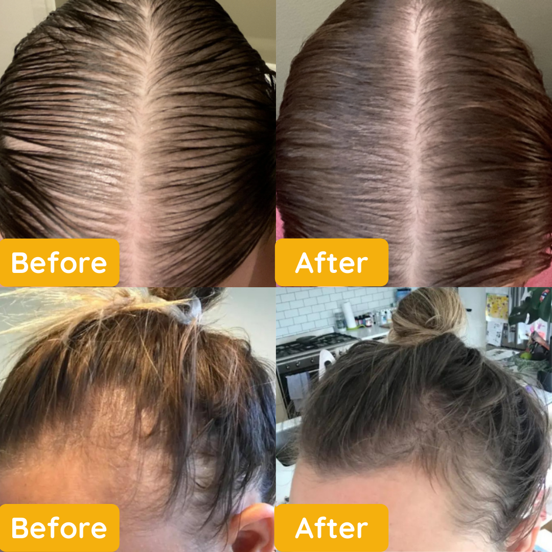 CurlPro™ Natural Hair Growth Oil